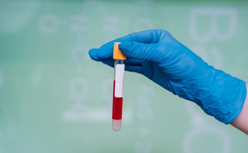 Hemograma: entenda o exame de sangue mais pedido pelos médicos